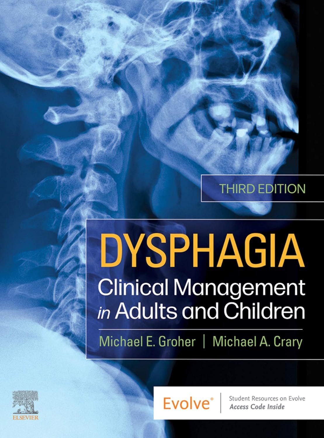 Dysphagia Master Guide: Evidence-Based Management for All Ages