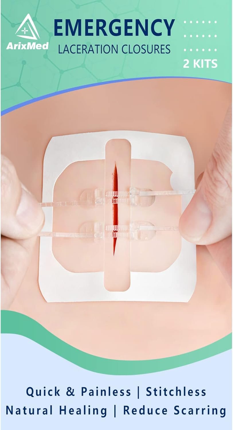 Quick, Painless Wound Closure Without Stitches