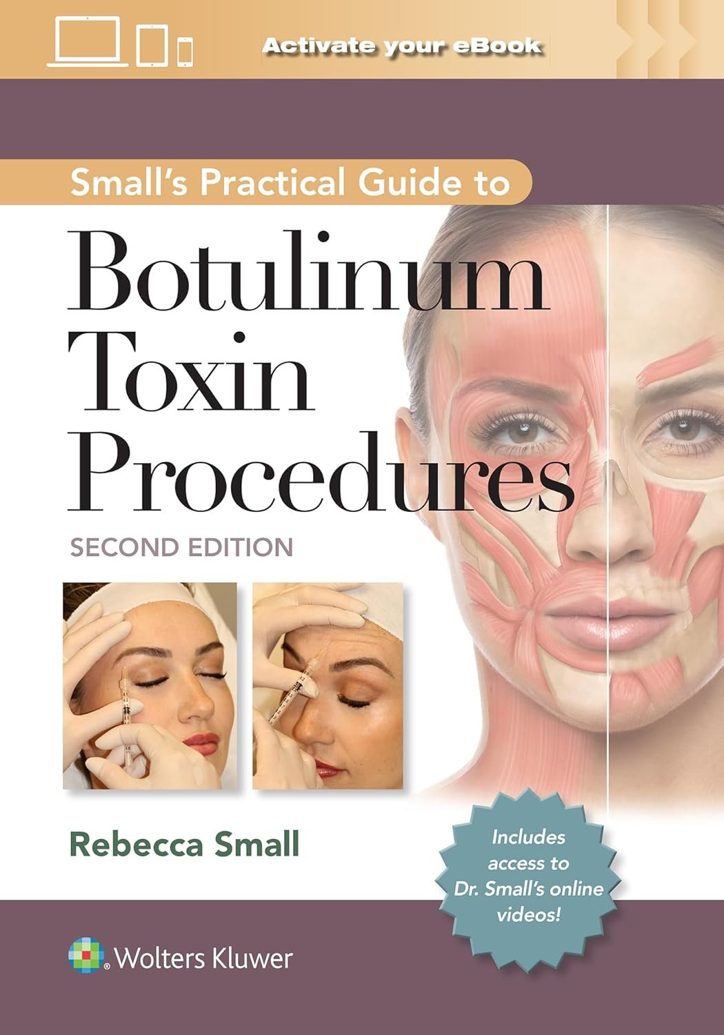 Master Botulinum Toxin Procedures: Small's Practical Guide
