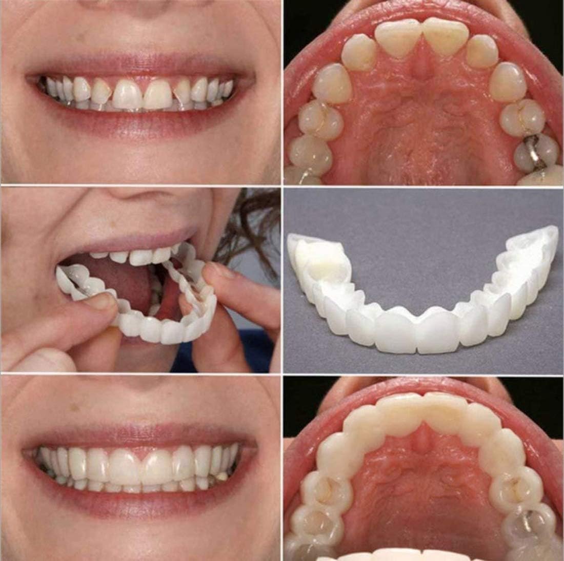 Instant Confidence: Temporary Teeth Cover for a Natural Smile