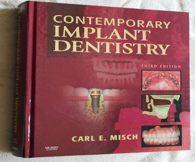 Master Dental Implants: Expert Techniques for Consistent Results