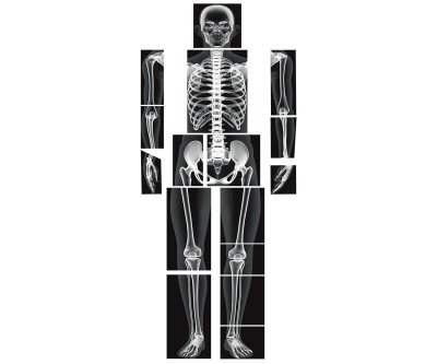 Discover Human Anatomy: 16 X-Ray Sheets for Kids