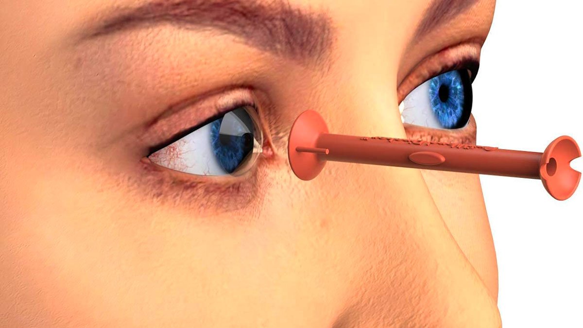 OptiWand Pincher Contact Lens Insertion & Removal Tool