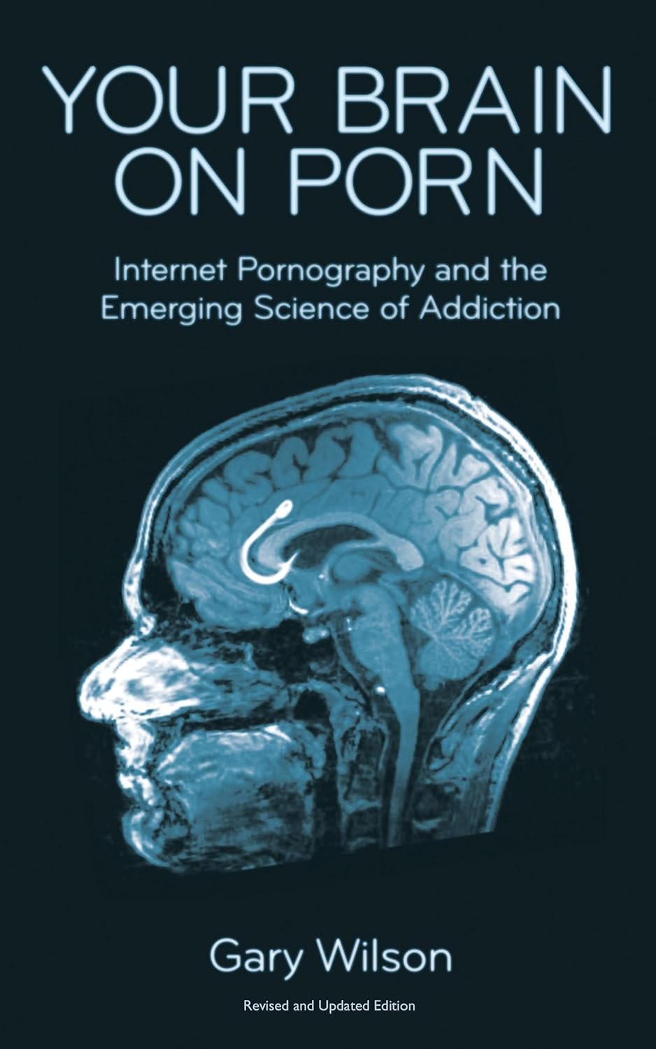 Your Brain on Porn: Understanding Addiction