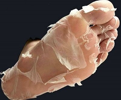 Exfoliating Foot Peel